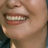 がん治療から生まれた帽子