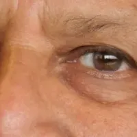 ユヌス博士来日セミナー