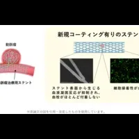 脳動脈瘤治療の革新