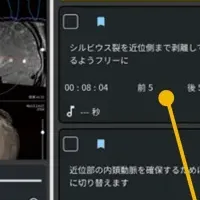 手術記録の進化