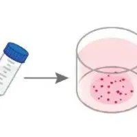 膵がんメカニズム解明