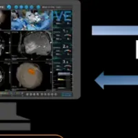 遠隔手術支援実現！