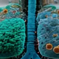 心臓代謝ケアの革新