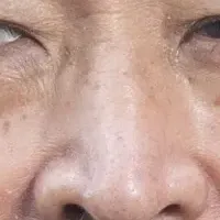 人口減少シンポジウム