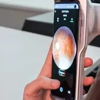 スマホで網膜検査